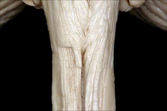 křížení lemniscus medialis, pyramidové dráhy; ncl.