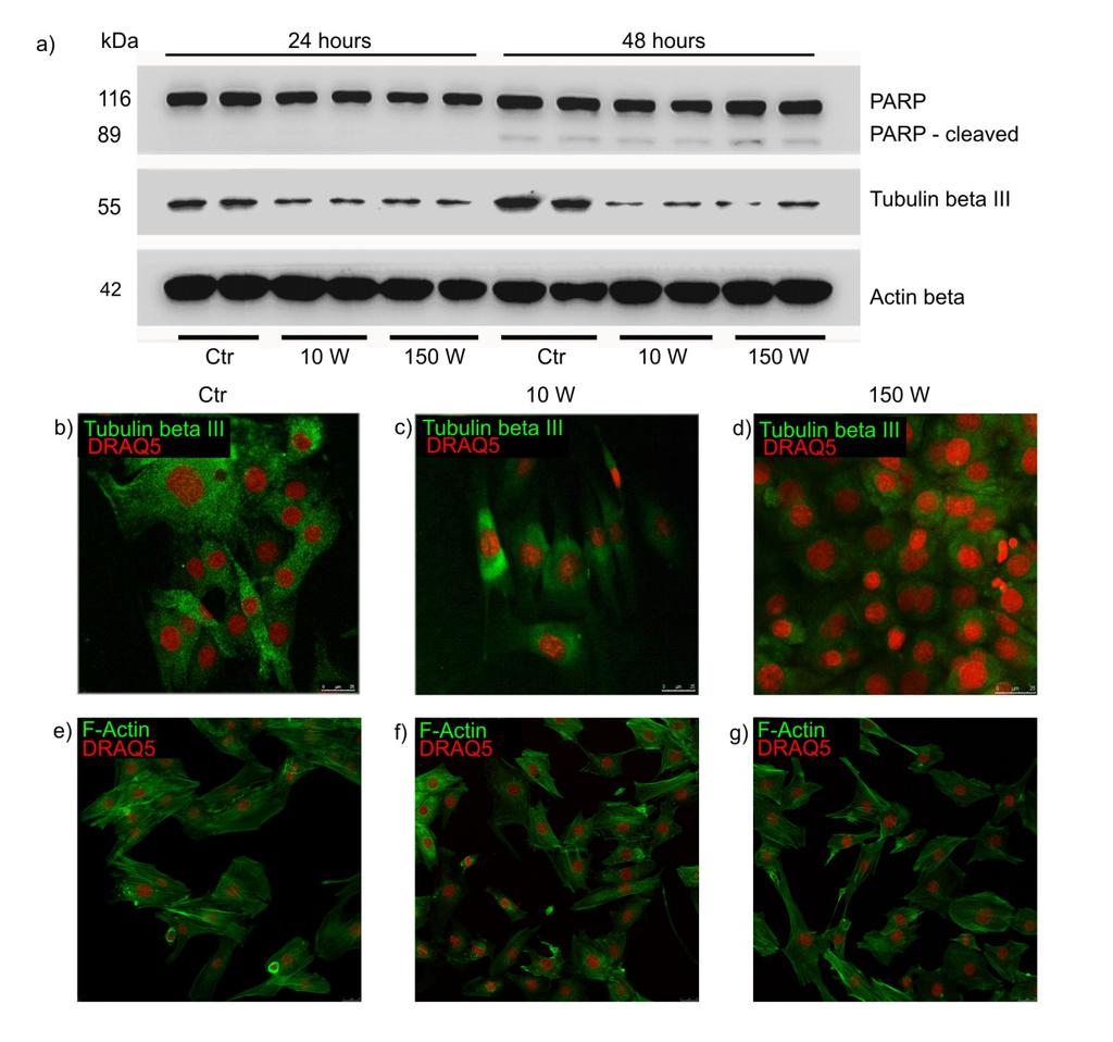 CPA a tubulin beta III