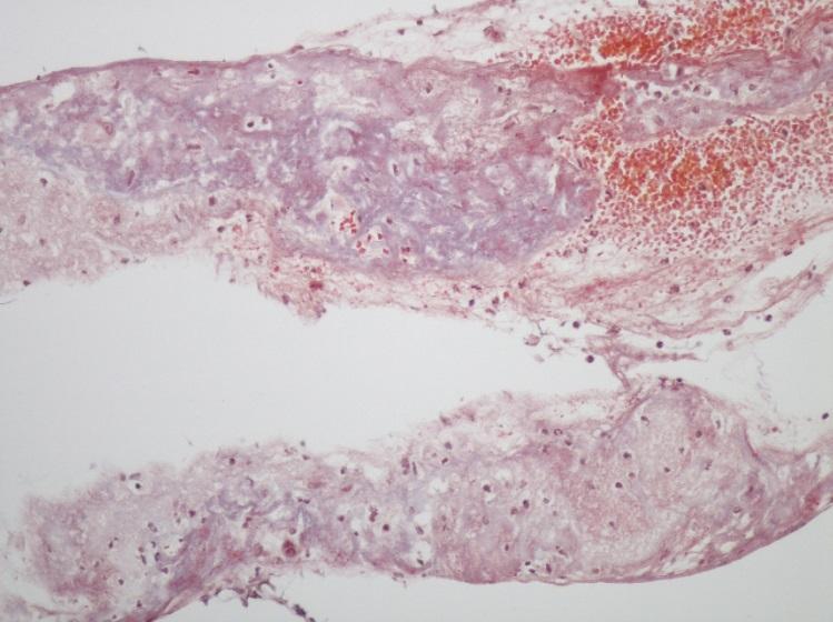 tkáň - fibroblasty) C.