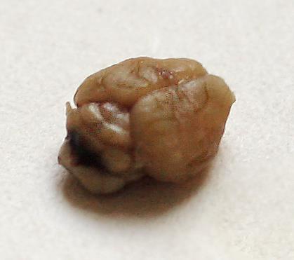 Úloha histologie v neuropatofyziologii Neuropatofyziologický výzkum- fyziologické a patologické