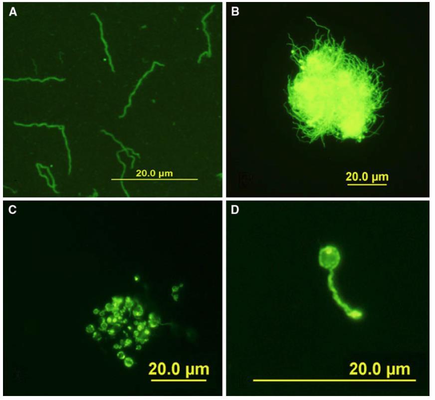 Obrázek č. 2: Morfologické formy Borrelia burgdorferi barvené karboxyfluoresceinsukcinimydylesterem a zobrazené ve fluorescenčním mikroskopu.