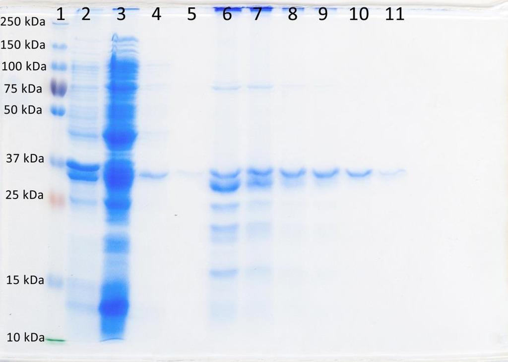 6. Výsledky V experimentální části své diplomové práce jsem provedla izolaci a purifikaci rekombinantního antigenu OspA spirochety Borrelia burgdorferi sensu stricto kmene B31 a vyhodnotila jeho
