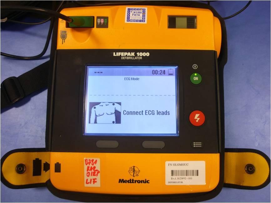 V těchto případech se defibrilací přeruší tento nezdravý stav pomocí silného elektrického výboje, aby se následně srdce mohlo pravidelně rozběhnout.