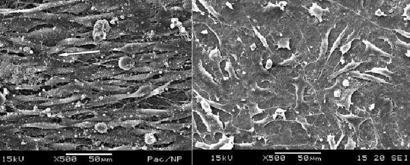 Textilní výroba scaffoldů Elektrostatické zvlákňování nitě Orientation of cell growing on different