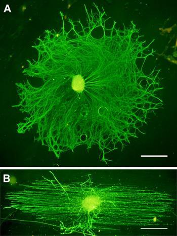 html Representative DRG stained for neurofilament (green) after 3 days of culture on PLL coated