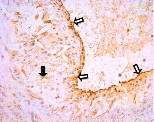 Obr.9 Imunohistochemické barvení SMAD 2/3 u atorvastatinové skupiny.