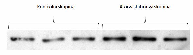 4.3 Western Blot analýza Western blot analýza exprese SMAD 2/3 Western blot analýza exprese SMAD 2/3 měla za cíl