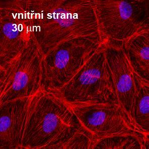 Jana Horáková Endothelial cells growing on the inner wall of