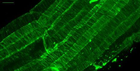 .. Aequorea victoria - je možné značit pouze fixované preparáty, nelze sledovat dynamiku Kořen Arabidopsis thaliana značený monoklonální protilátkou proti tubulinu α, sekundární protilátka