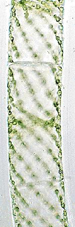 Zaostřovací šroub Čočka Spirogyra sp.