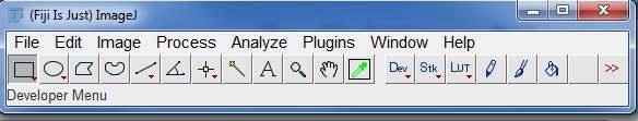 Software pro zpracování mikroskopických obrázků Image J NIS Elements ZEN lite Imaris Huygens Předzpracování obrazu odstín, sytost barvy, jas, kontrast - většinou pouze vylepšení optické