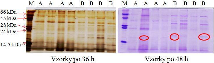 20. Extracelulární exprese receptorů rnkr-p1 v Pichia pastoris Po vyhodnocení výsledků z optimalizace produkce, proběhla exprese ţádaných proteinů ještě jednou. Na následujícím panelu (obr.