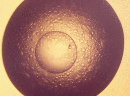 3.1.8 Fázová separace (Phase separation) Obr. 22: Fázová separace (převzato od Bergfors) 3.1.9 Sferulity (Sperulites) Obr.