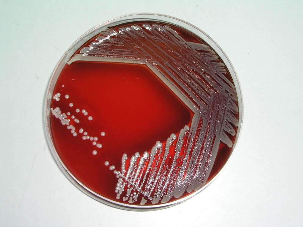 Staphylococcus aureus Morfologie: pigmentované hladké kolonie, nejčastěji