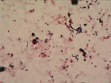 Streptococcus Gram pozitivní koky Uspořádané nejčastěji ve dvojicích, v řetízcích