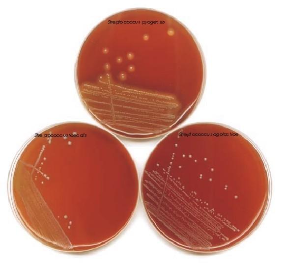 Streptococcus pyogenes Kolonie drobné, lesklé, kolem zóna