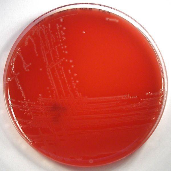 Streptococcus agalactiae Kolonie na