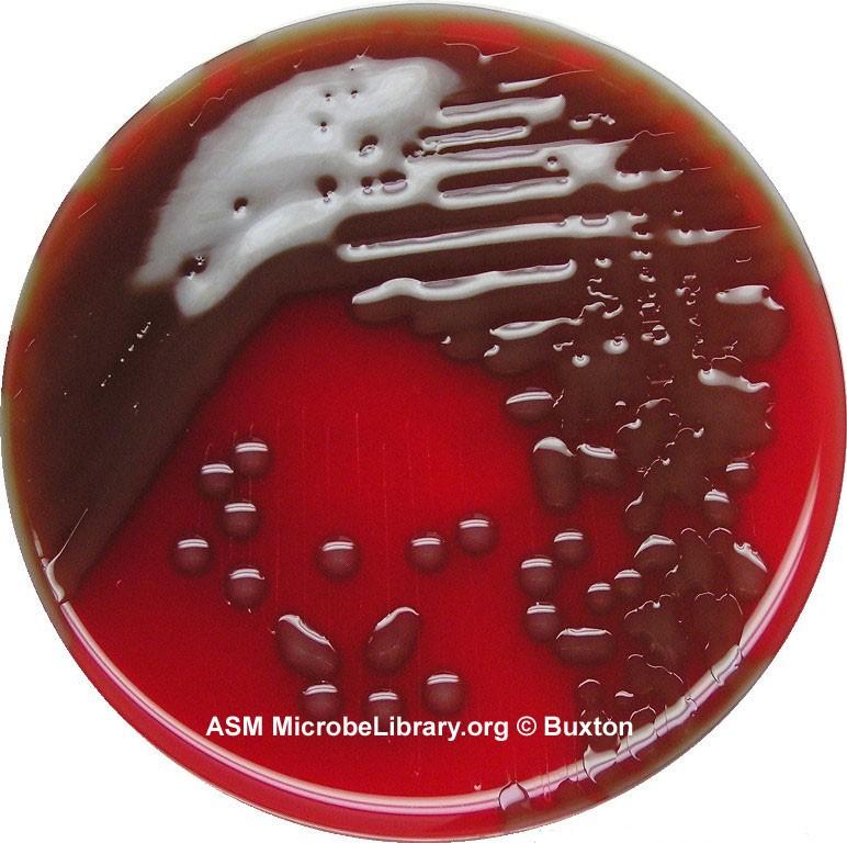 Streptococcus pneumoniae