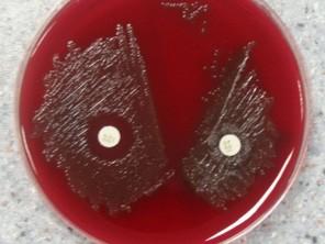 Streptococcus pneumoniae laboratorní průkaz Materiál k vyšetření: sputum, krev, punktáty, likvor, moč k průkazu antigenu, Mikroskopie: G+ koky ve dvojicích, pouzdro,