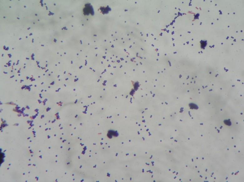Staphylococcus Grampozitivní koky uspořádané nejčastěji ve shlucích