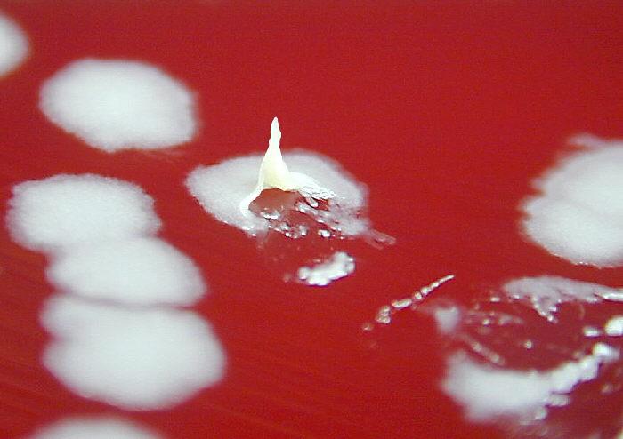 Bacillus anthracis