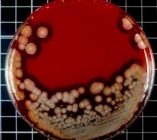 Bacillus cereus Význam: původce závažných infekcí oka a enterotoxikóz, nachází se