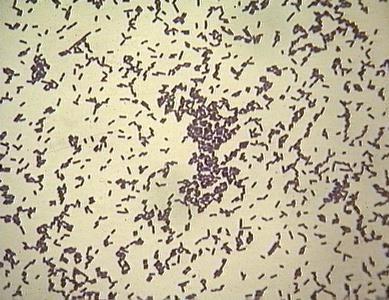 Listeria Morfologie: rovná G+ tyčka, pohyblivá při teplotě do 25 C Kultivace: kultivačně nenáročná, běžné kultivační půdy i teploty,