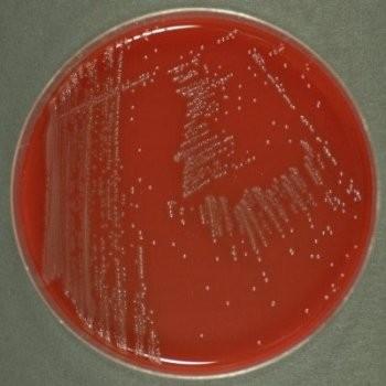 Listeria laboratorní diagnostika Materiál k