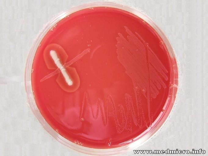 Arcanobacterium Laboratorní diagnostika: Mikroskopie: G+ tyčky.