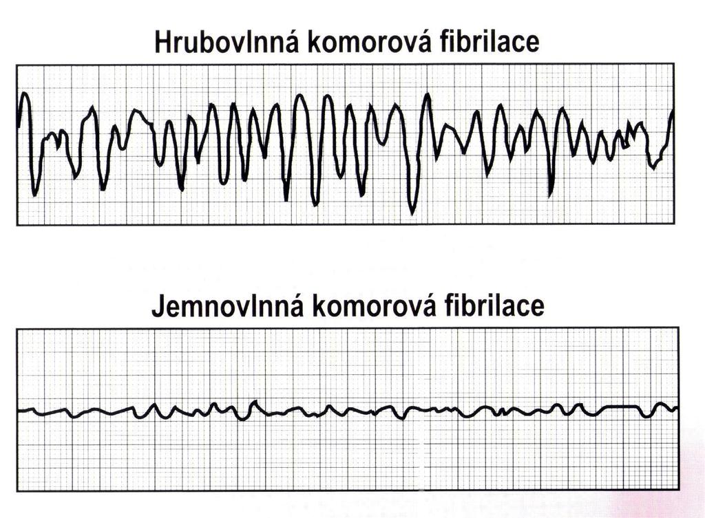 elektrické aktivity je