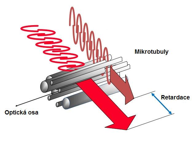 Diagnostické metody glaukomu 35 Nerve fiber analyzer (GDx) Analyzátor nervových vláken umožňuje pomocí polarizovaného světla zjistit tloušťku vrstvy nervových vláken.
