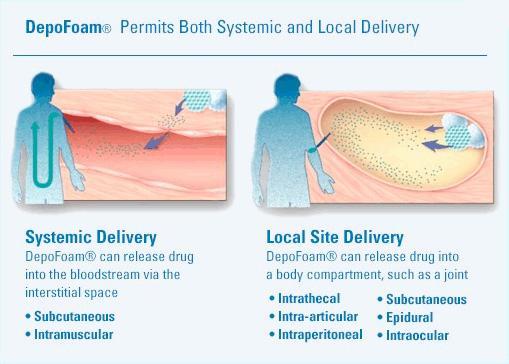 Depofoam