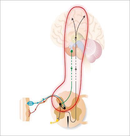 Mechanismus vzniku CHPOB Periferní senzitizace Snížení prahu bolesti Hyperalgezie Alodynie Centrální senzitizace Rozšíření