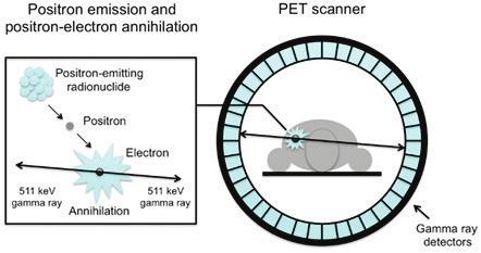 (PET) (CT) (PET/CT) A B Obr.