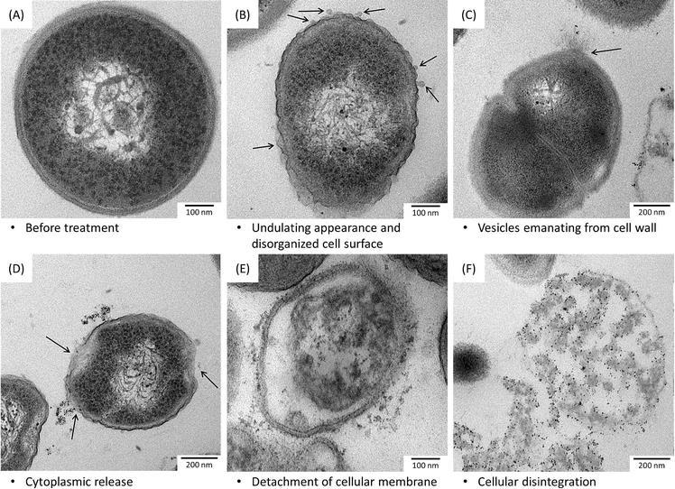 EFEKT KATIONTŮ STŘÍBRA NA STAPHYLOCOCCUS