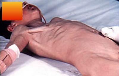 Přes veškerou snahu někdy pacienti dopadnou takto http://pharmacie.