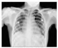 strana 7 a) Radiografie x-ray
