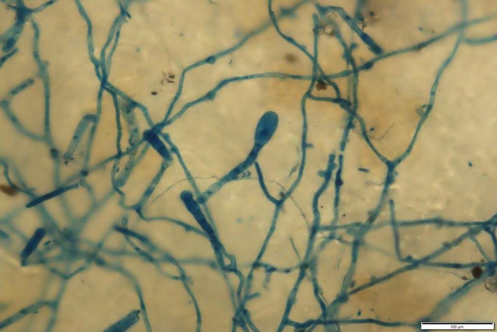 Mycelium Konidiofor Konidie Obr.