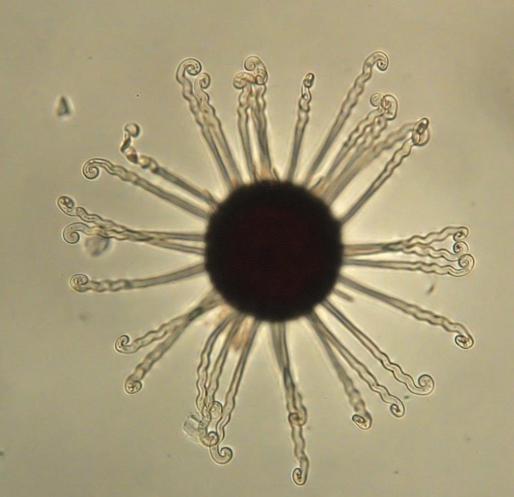 Délka apendixů Průměr chasmothecia Obr. 15: Mikrofotografie pohlavního stádia Erysiphe flexuosa, foto Ascherová M. U každé struktury bylo provedeno 30 měření.