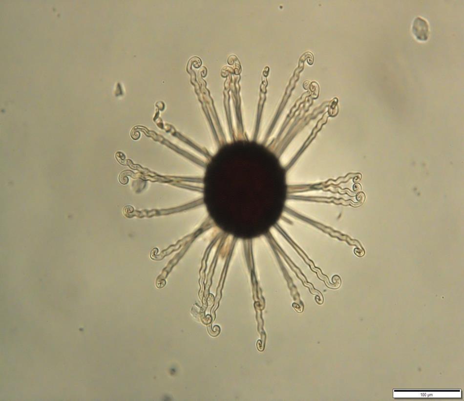 Obr. 32: Mikrofotografie chasmothecia padlí