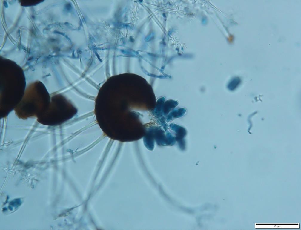 Obr. 37: Mikrofotografie chasmothecia a vřecka
