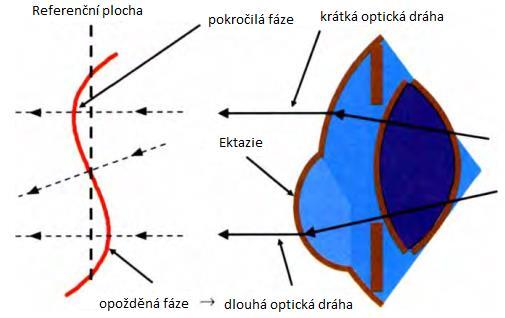 vystoupit dříve, protože se paprsek síří rychleji. To znamená, že fáze oscilujícího vlnoplochy je napřed, což se podle konvence považuje za pozitivní wavefront aberaci.