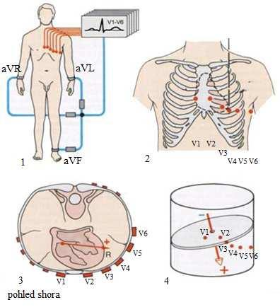V 1 4. mezižebří parasterálně vpravo, V 2 4. mezižebří parasternálně vlevo, V 3 - mezi V 2 - V 4, V 4 5.