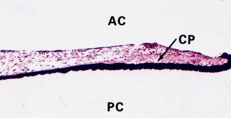 Vrstvy duhovky přední plocha nemá epitelový kryt (stratum limitans anterius)