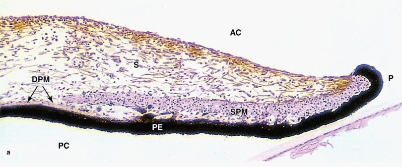 (cellula congregata Koganei) epithelium iridicum 2 vrstvy epithelum
