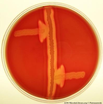 CAMP test - je test založený na schopnosti Streptococcus agalactiae produkovat proteinovou substanci, která hemolyzuje beraní erytrocyty v přítomnosti stafylokokového ß lyzinu.