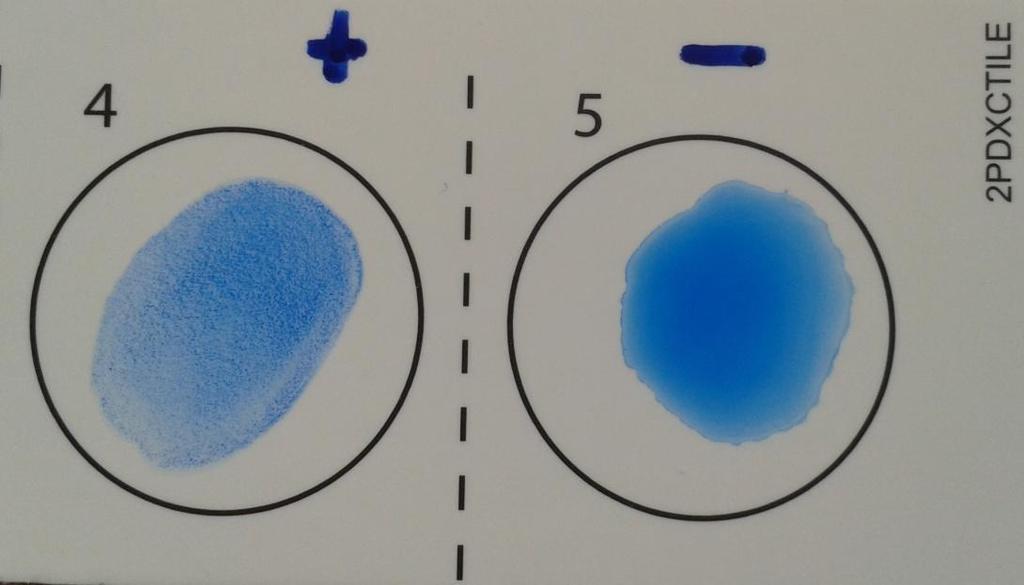Obrázek 4 Aglutinační test na rozlišení ß hemolytických streptokoků, vlevo pozitivní ß-hemolytický streptokok (aglutinace), vpravo negativní aglutinace 4.