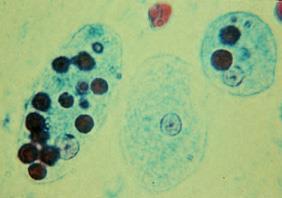 parazity (cysty a trofozoiti), serologie Napodobuje,