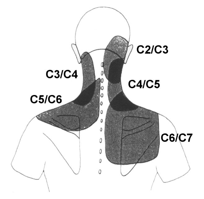 Poruchy pohybového systému Obrázek 8. HAZ u dysfunkce krční páteře (C2 C7) (upraveno z Liebenson et al.