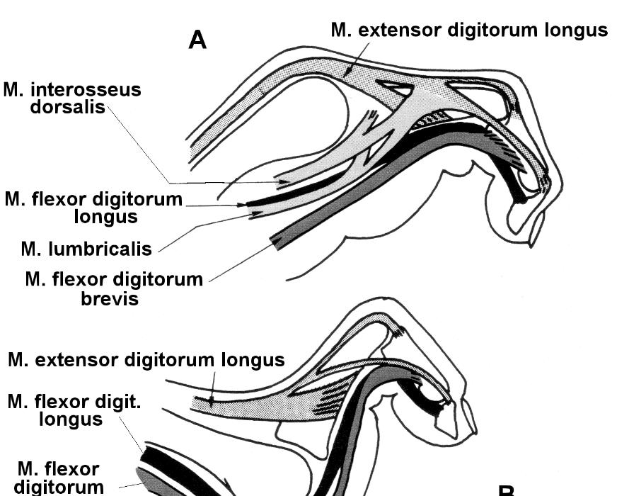 Komplexní kineziologický rozbor Obrázek 27. Deformity prstců (upraveno z Palastanga, Field, & Soames, 1998) Vysvětlivky: A drápovité prstce zkrácení, převážně vazivové, m. flexor digitorum longus + m.